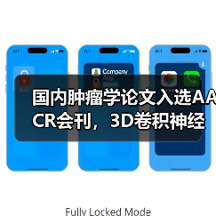 国内肿瘤学论文入选AACR会刊,3D卷积神经网络助力早期肿瘤浸润研究(图1) 国内肿瘤学论文入选AACR会刊,3D卷积神经网络助力早期肿瘤浸润研究(图1)