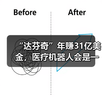 “达芬奇”年赚31亿美金,医疗机器人会是一门好生意吗?(图1) “达芬奇”年赚31亿美金,医疗机器人会是一门好生意吗?(图1)